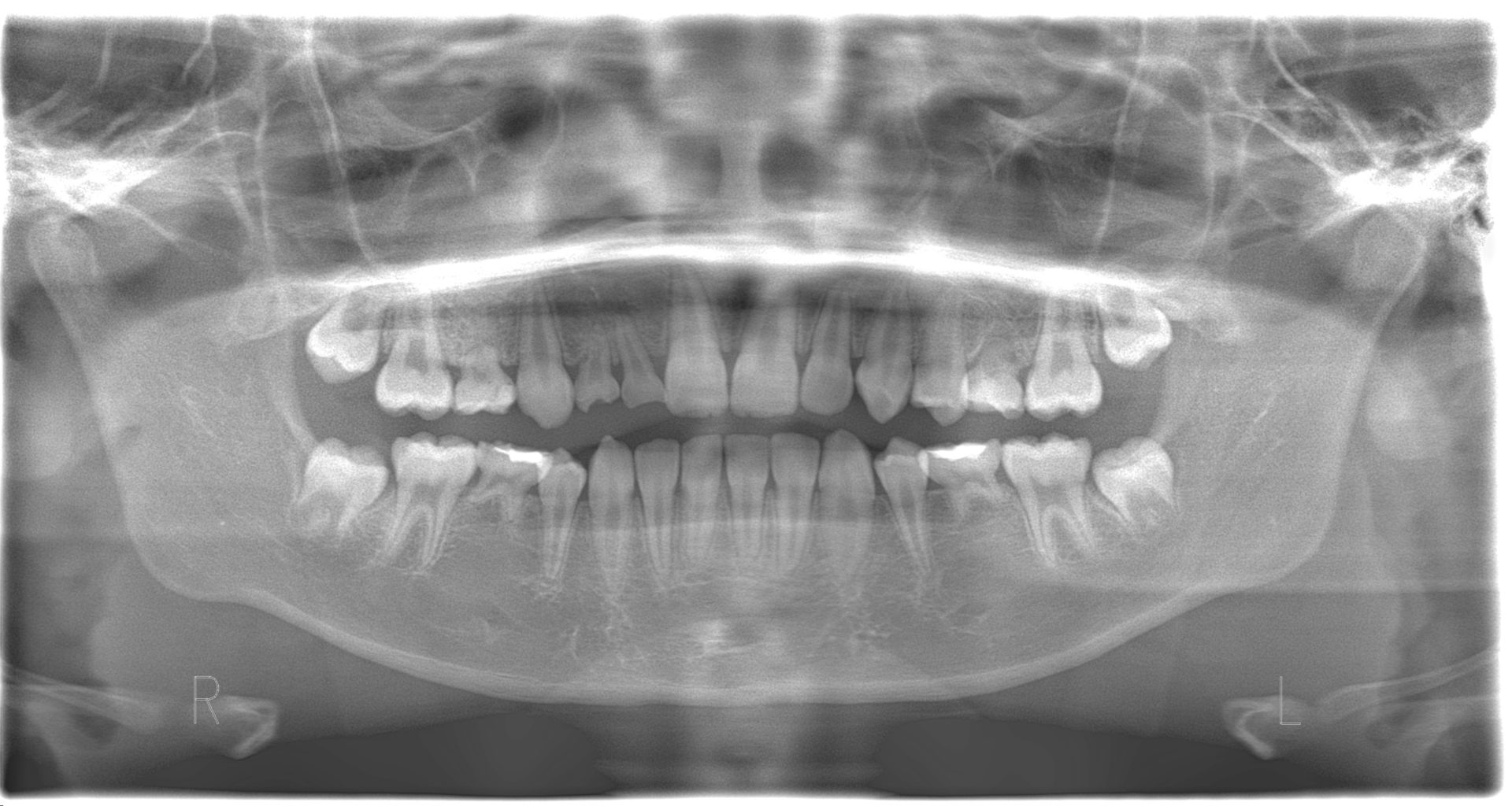 乳歯から永久歯の交換期について ネット予約可 静岡市の歯医者は小嶋デンタルクリニック