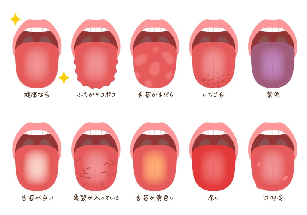 舌 に 紫 の 斑点