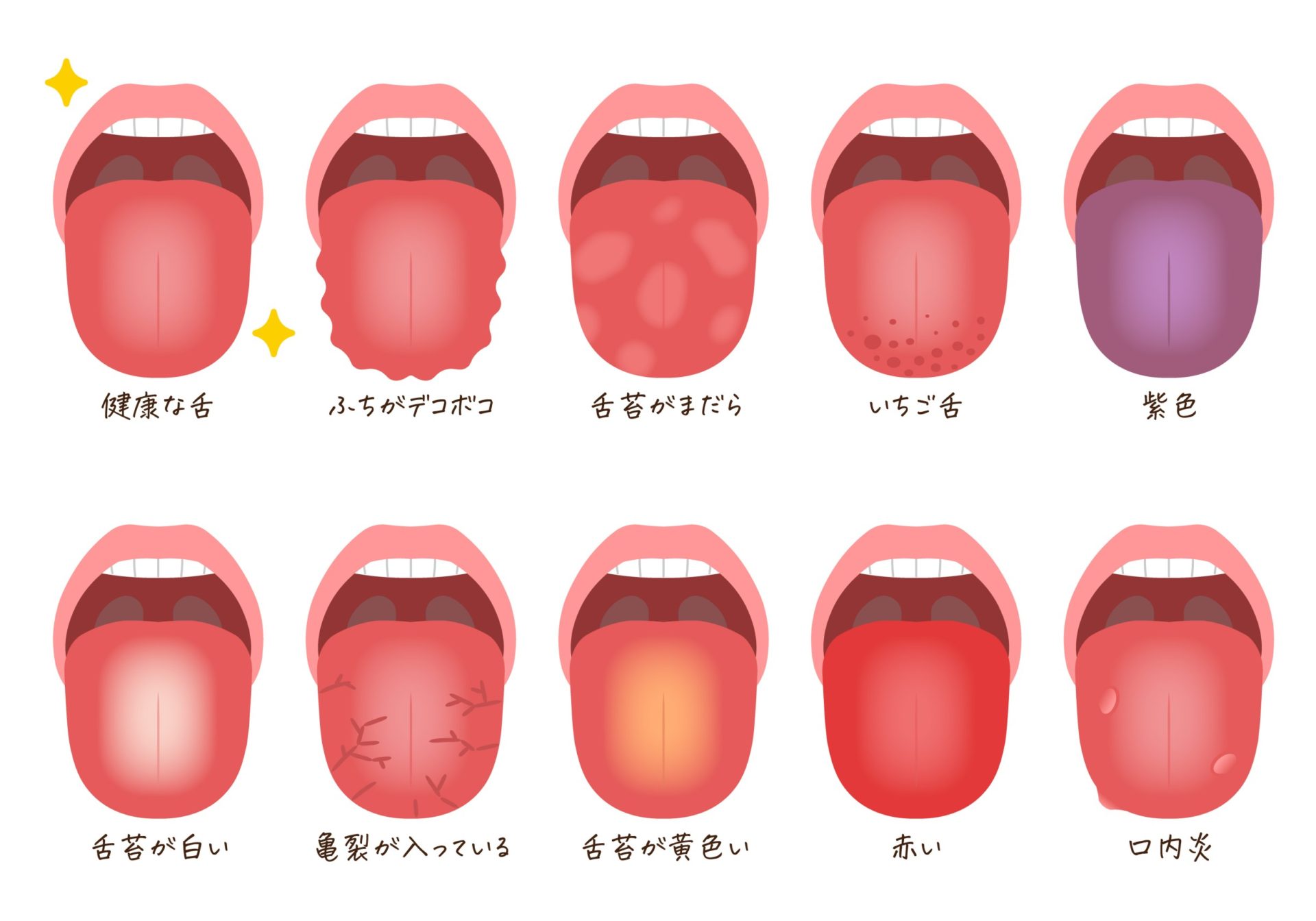 舌が白い
